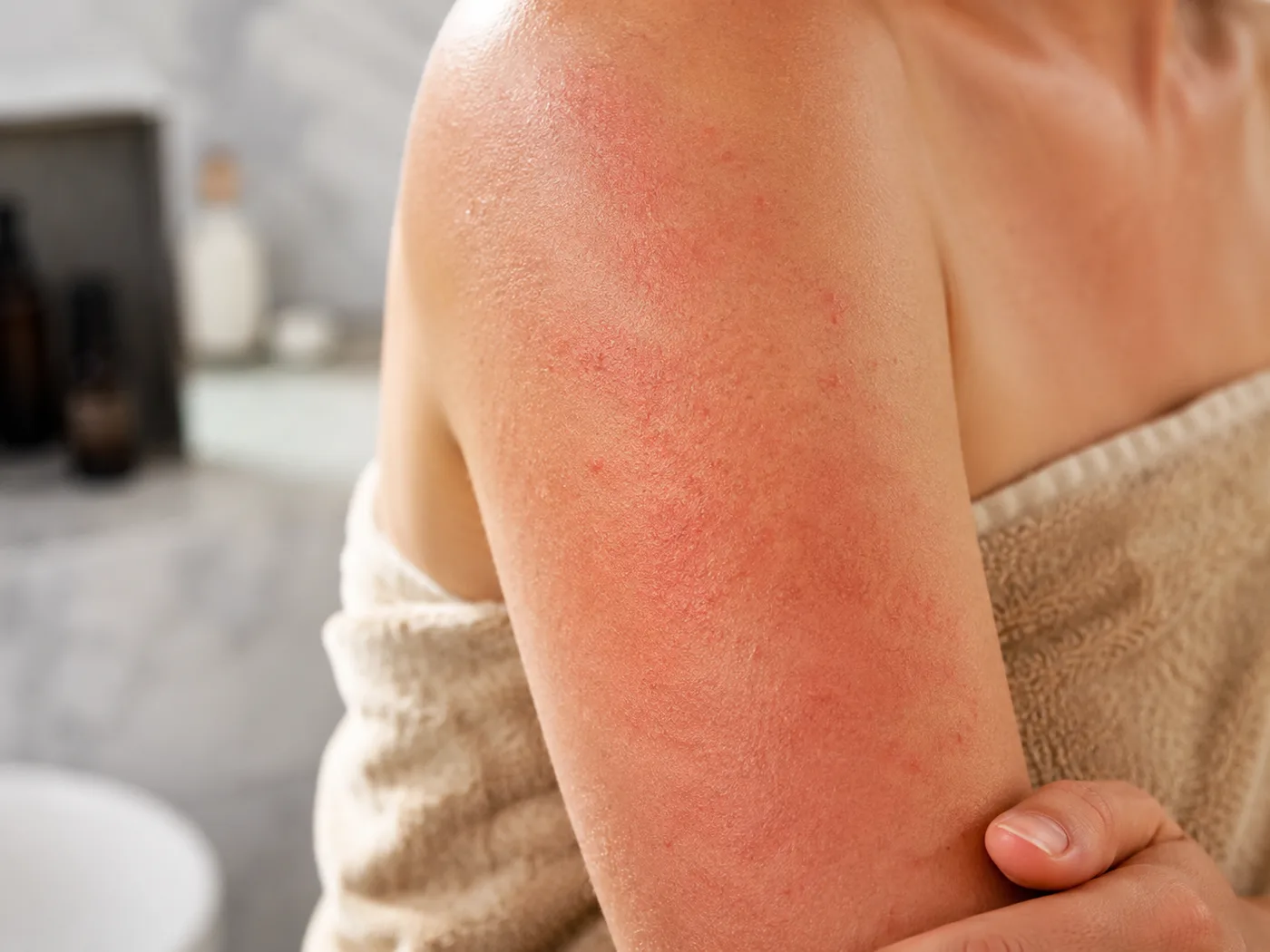 Body Scrub Makes Skin Red