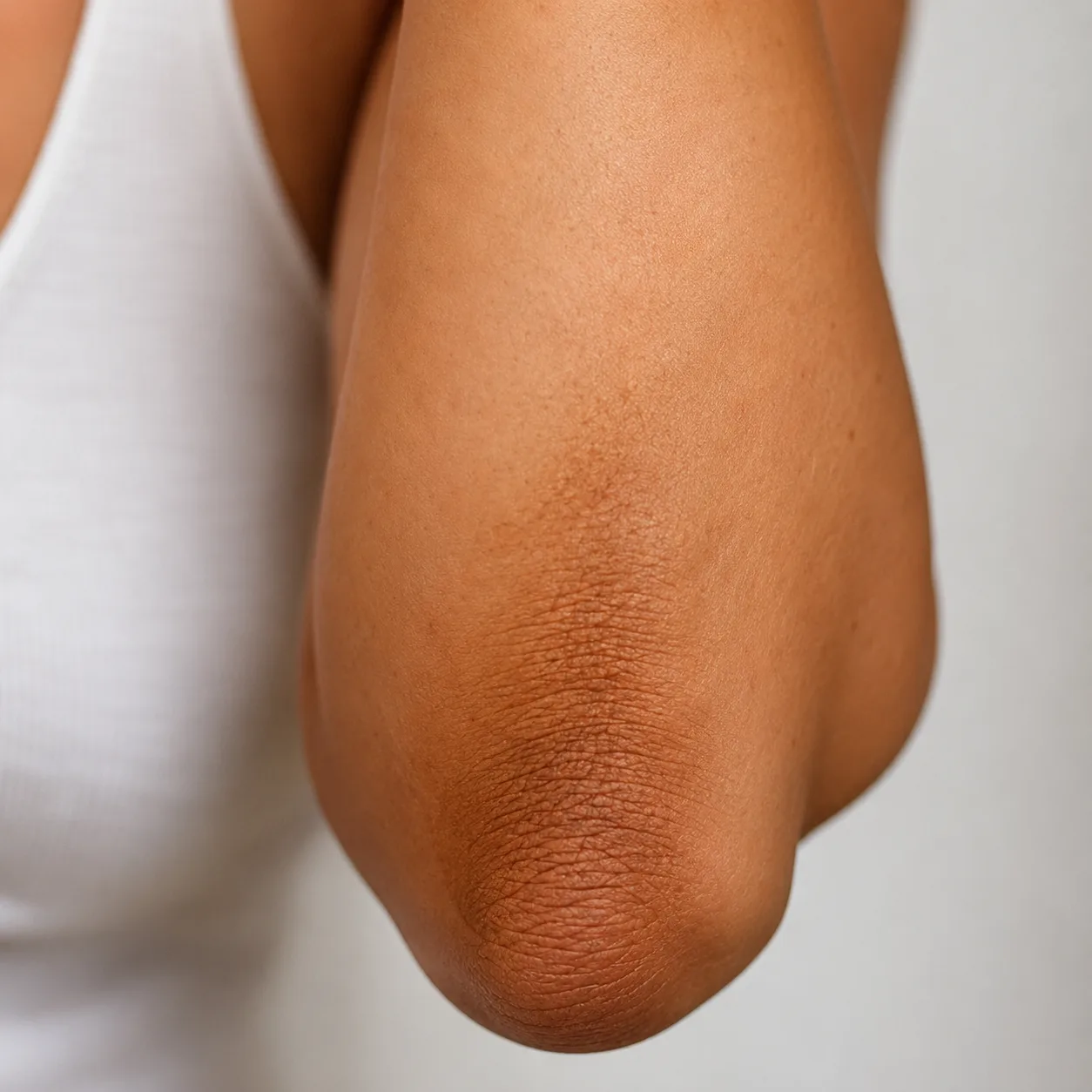 Spray Tan Creases at Elbows